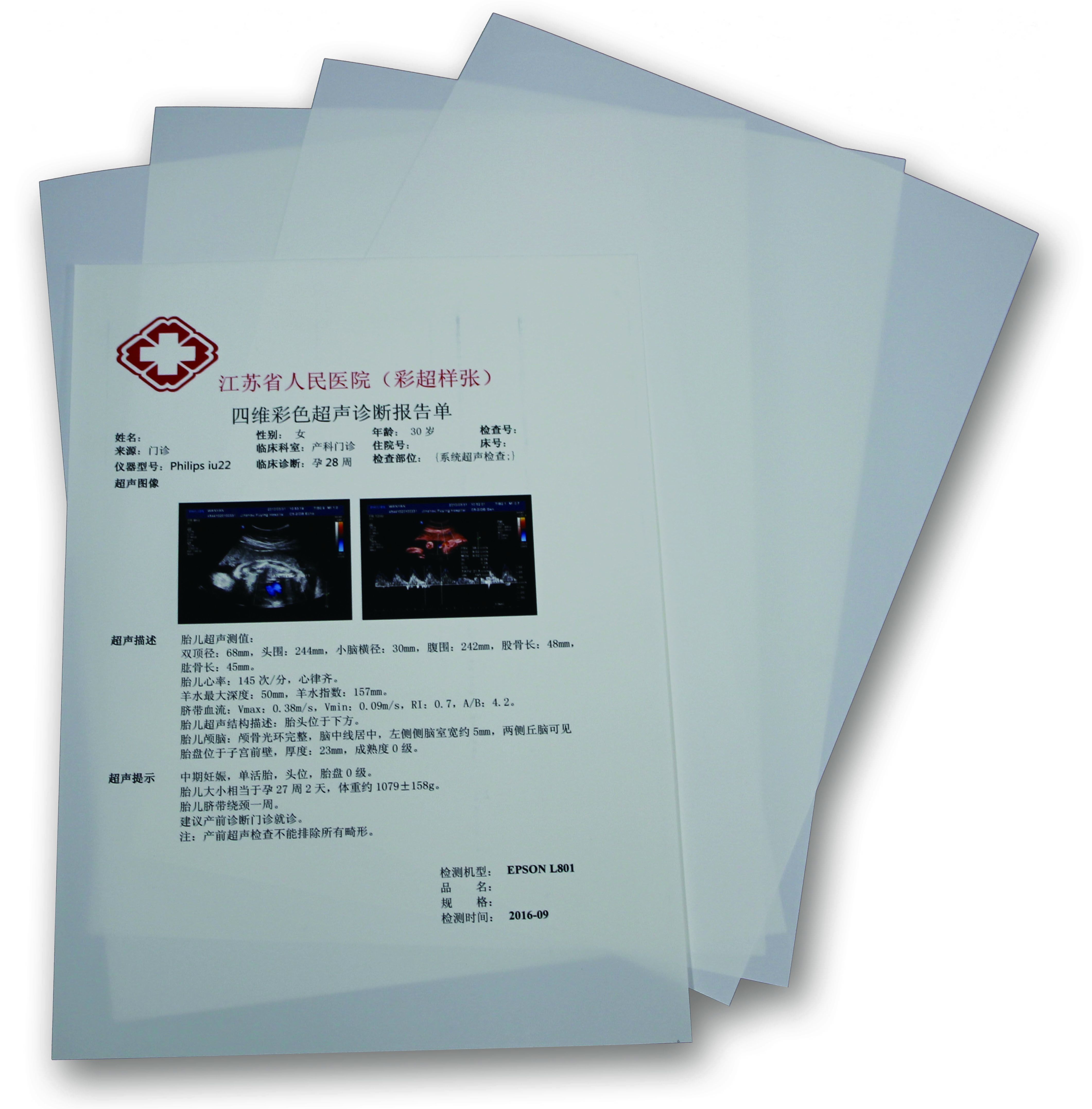 超声医用打印胶片