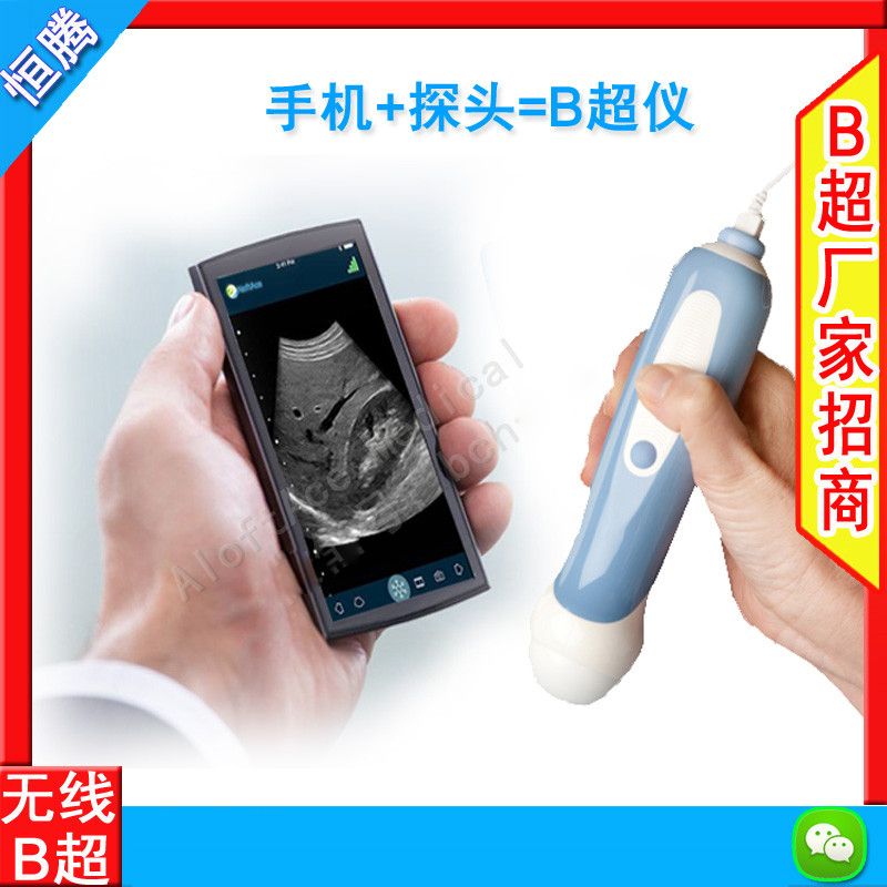 无线探头式B超/超声诊断仪