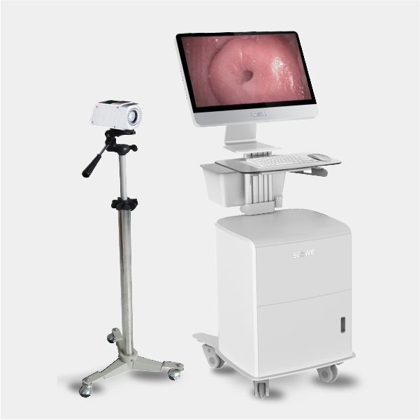 数码电子阴道镜SW-3304