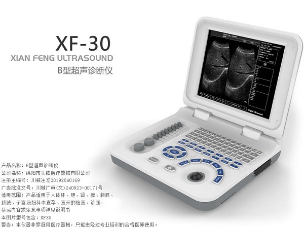 B型超声诊断仪/B超机/B超/超声诊断仪/超声仪/超声诊断系统