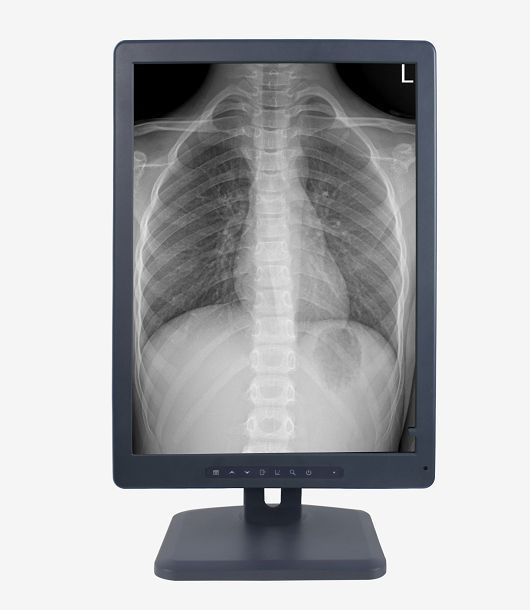 2M灰阶医用显示器