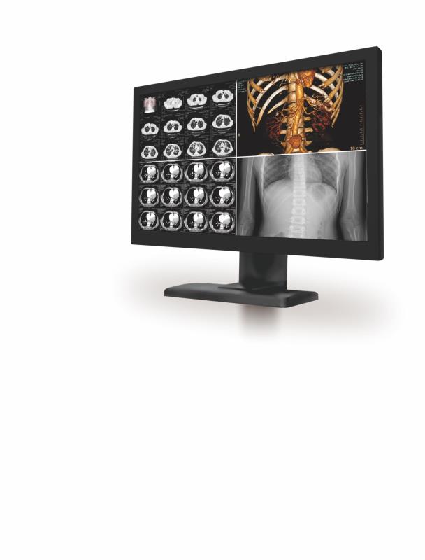 4M一体化双屏医用显示器