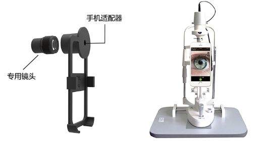 泰立瑞显拍助手(眼科)