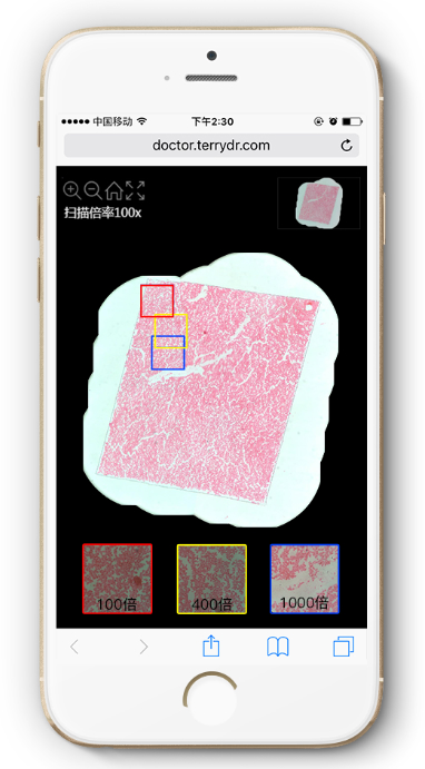 泰瑞镜下数字病理全切片扫描系统