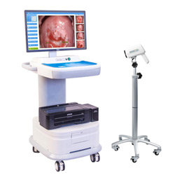 电子阴道镜(327 万像素超高清)