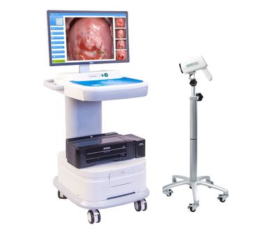 金舜康GC-5000E电子阴道镜