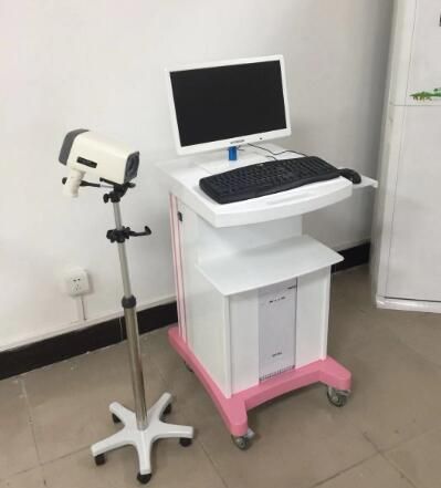 高清数码电子阴道镜