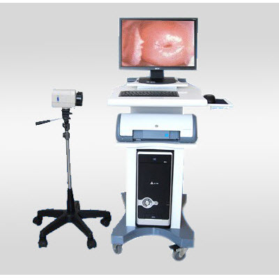电子阴道镜 WH-SMA
