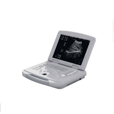 笔记本全数字超声诊断仪 DW-500