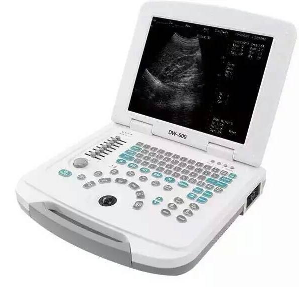 笔记本全数字超声诊断仪 DW-580