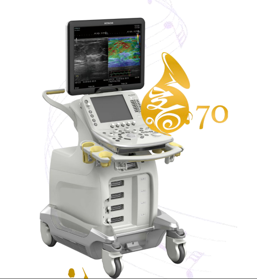 彩色超声诊断系统 Affiniti 70