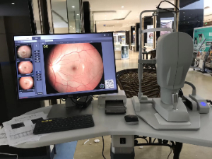 免散瞳眼底照相机 SW-8800