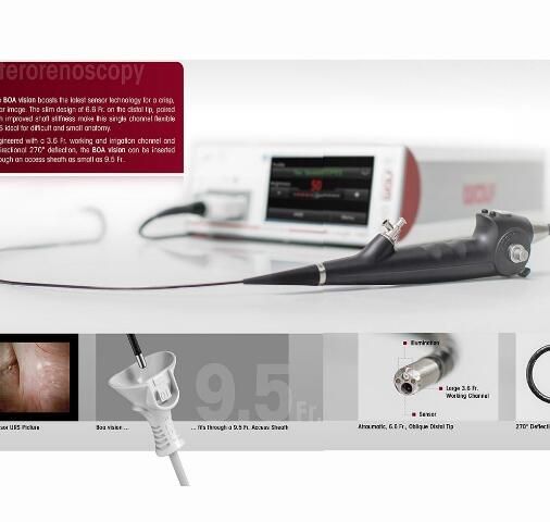 单通道微创经皮肾镜与电子输尿管软镜7355071