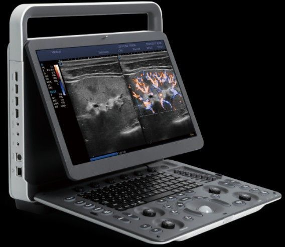 开立便携式彩超