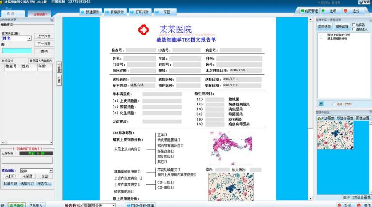 液基细胞图文报告系统/液基细胞图文软件