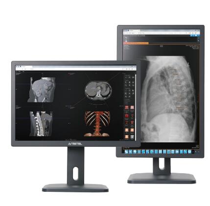 奥斯泰24寸医用灰阶显示器