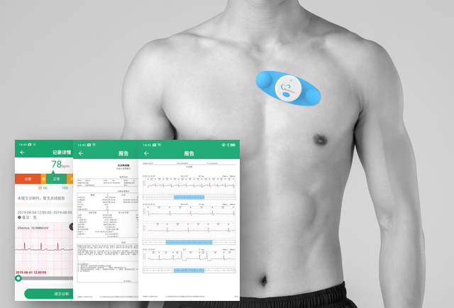 智能可穿戴心电记录仪
