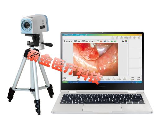 电子阴道镜 (便携式)、数码阴道镜、阴道镜