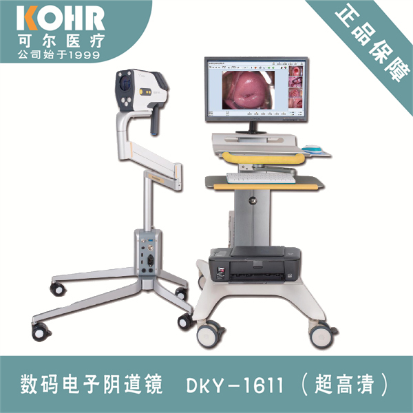 数码电子阴道镜/高清阴道镜/数字阴道镜