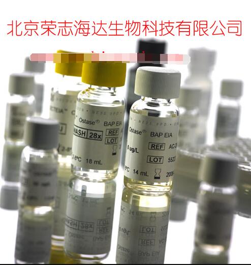 艾狄斯?骨碱性磷酸酶检测试剂盒(酶联免疫法)