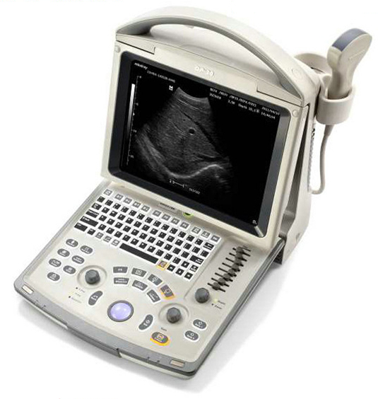 迈瑞黑白超 全数字便携式超声诊断系统 DP-30 手提式B超机