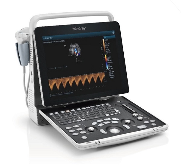 迈瑞 便携式彩色多普勒超声系统 Z50BW 个人门诊彩色超声