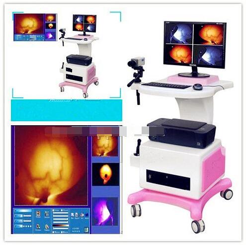 红外乳腺诊断仪(1200便携式)