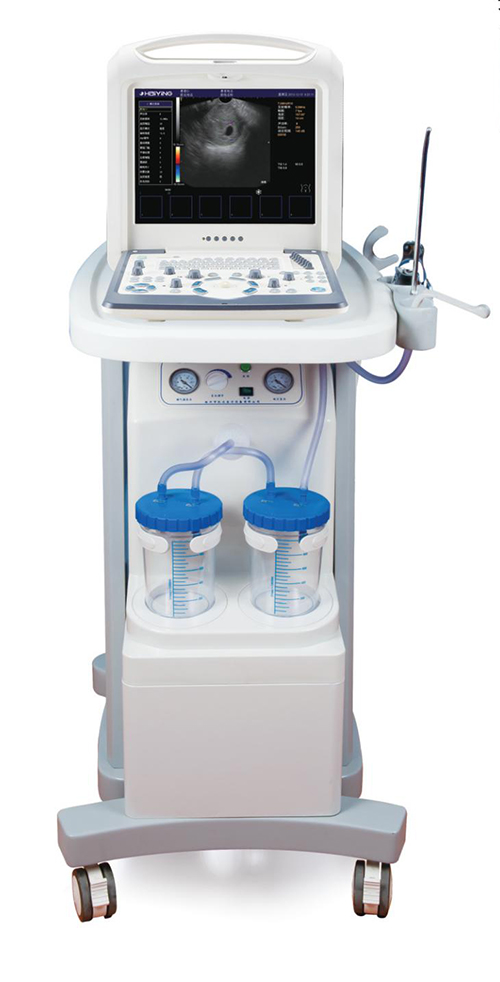 彩色可视人流诊疗系统/彩超可视