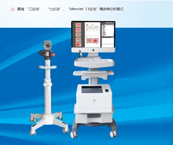 医用电子皮肤检测仪/皮肤镜批发招商