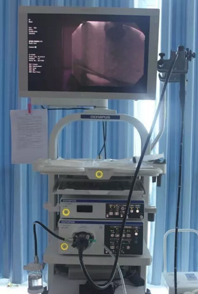 奥辉胃肠镜日本CV-V1奥林巴斯电子消化内镜