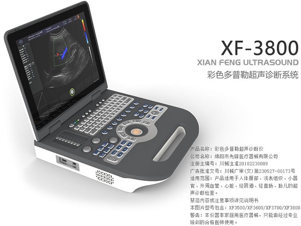 彩色多普勒超声诊断仪/彩超/彩超机/B超机/B超/超声诊断仪/超声仪/多普勒/多普勒诊断系统