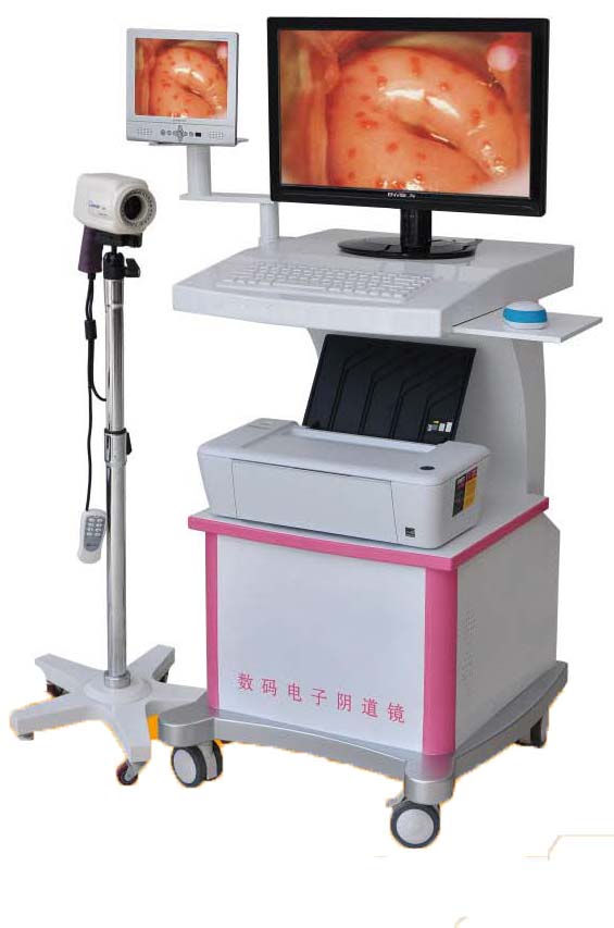 数码电子阴道镜配件高清SONY镜头