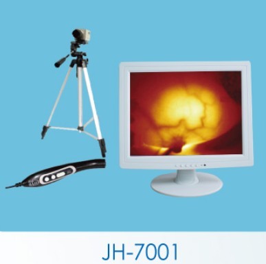 佳华乳腺诊断仪