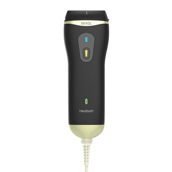 微型彩色超声诊断系统