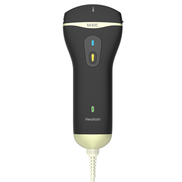 微型彩色超声诊断系统