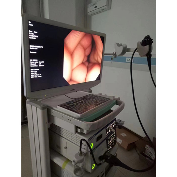 CV-290奥林巴斯电子胃镜电子胃肠镜系统无痛胃镜型号参数图片电子胃肠镜报价民营医院专用