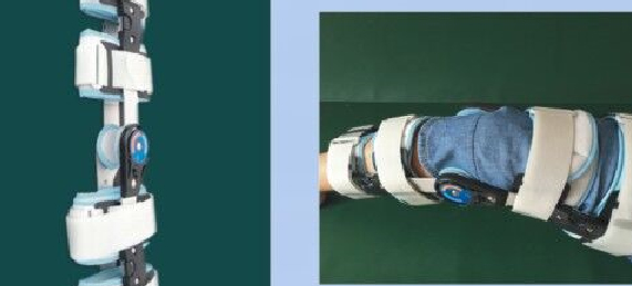 /膝关节矫形支具/膝关节固定支具/膝部术后恢复支具