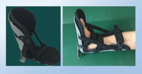 足踝固定支具/股胫腓固定支具/胫腓骨支具