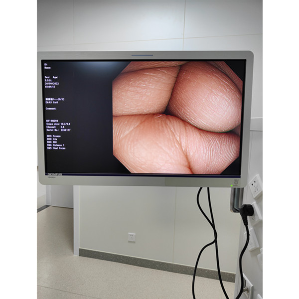 奥林巴斯电子胃肠镜用原装监视器 奥林巴斯医用显示器OEV262H