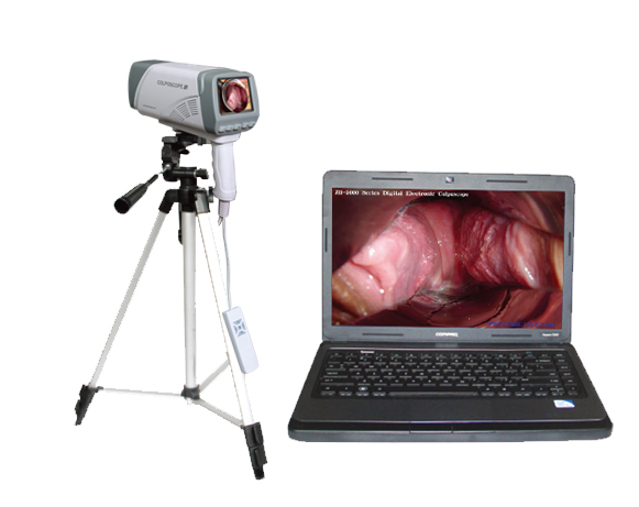 便携款阴道镜数码阴道镜厂家