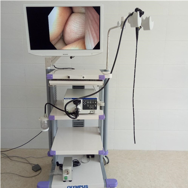 奥林巴斯高清电子胃肠镜CV-170全套配置奥林巴斯胃肠镜民营代理