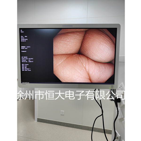 奥林巴斯CV-290高清电子内窥镜系统 奥林巴斯cv-290配置报价