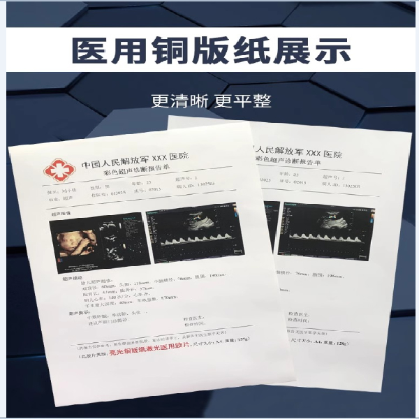 医用激光铜版纸/医用喷墨铜版纸