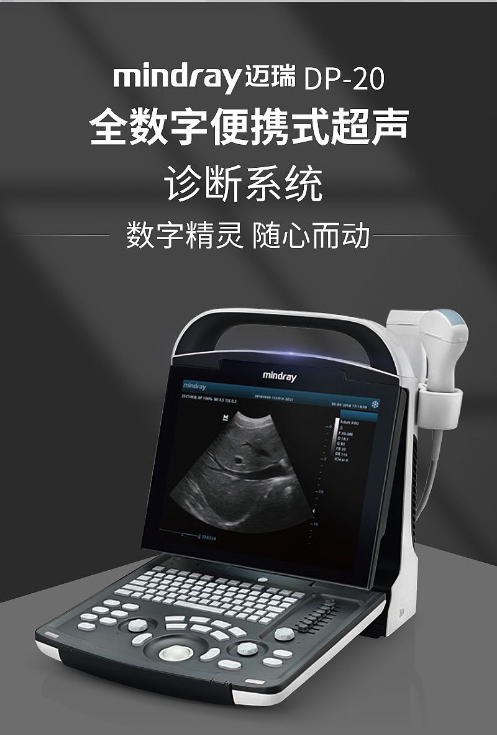迈瑞便携式超声诊断仪DP-20